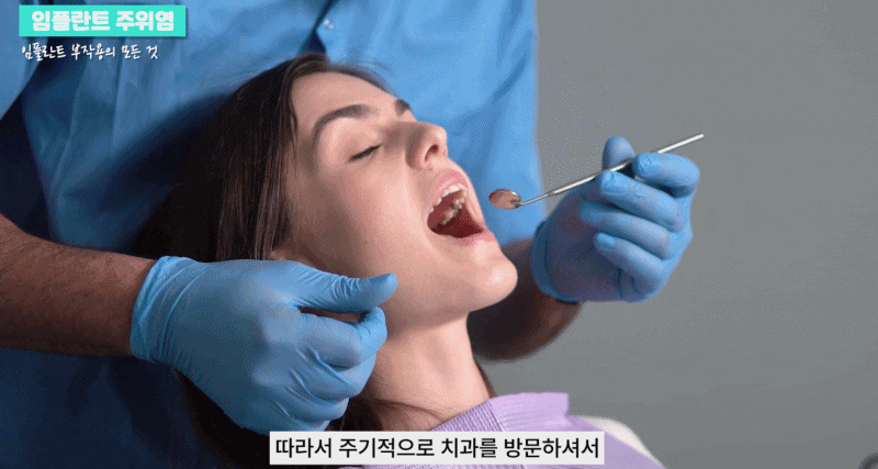 Gangnam Peri-Implantitis: Causes, Symptoms, and Prevention image 13