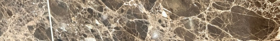 신논현역치아교정 당신의 라이프스타일에 맞는 선택 관련 이미지 28