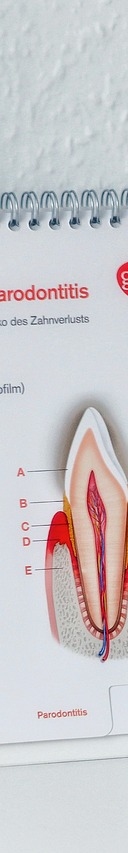이시림 증상 원인 및 예방 방법 관련 이미지 17