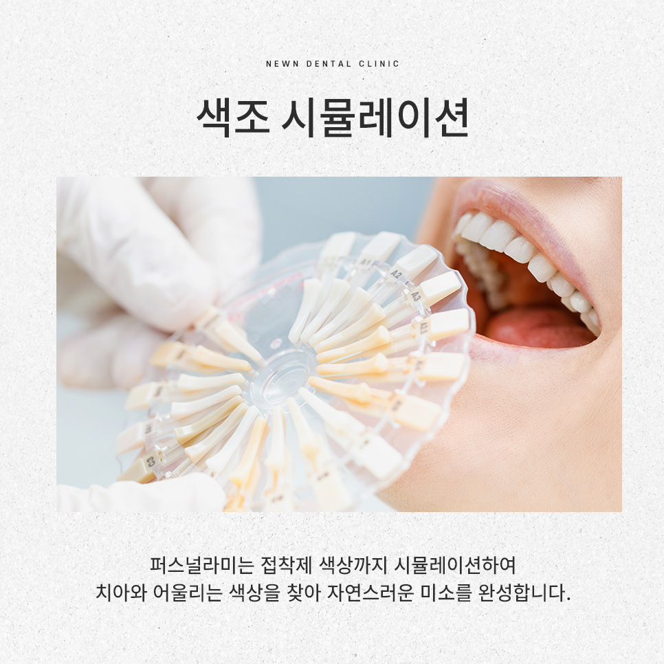 강남역 뉴엔치과 일반 라미네이트와 퍼스널라미의 차이점 관련 이미지 16