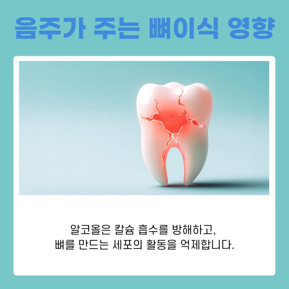 강남역치과 임플란트 뼈이식, 흡연과 음주가 미치는 영향은? 관련 이미지 5