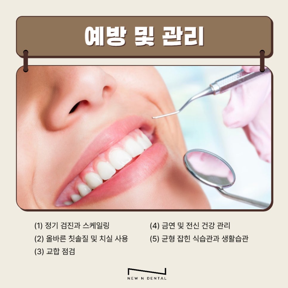 강남역 임플란트 치과 임플란트주위염 원인,증상,치료방법 관련 이미지 5