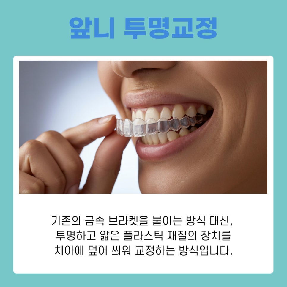앞니투명교정, 강남치아교정치과에서 궁금증 해결하기 관련 이미지 3