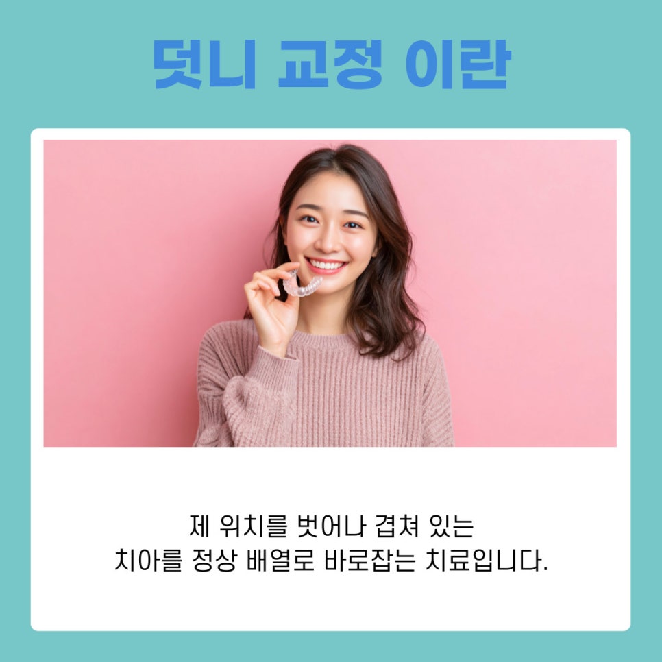 덧니 교정 발치 여부 어떻게 결정될까 관련 이미지 3