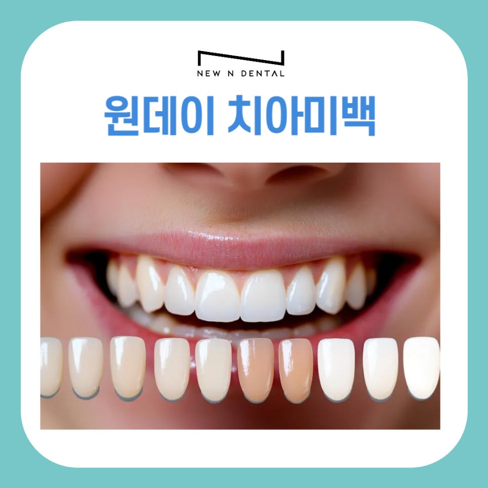 원데이치아미백 으로 누렁니 탈출 관련 이미지 1