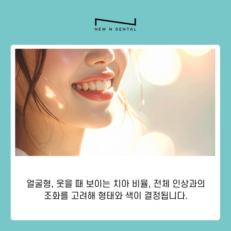 라미네이트 치아삭제 없이도 가능한 치아성형 알아보기 관련 이미지 6
