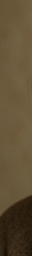 강남임플란트틀니 치아 기능과 심미성 회복하는 방법 관련 이미지 8