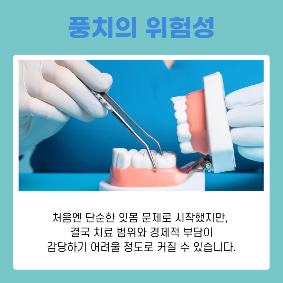 풍치증상 처음 나타나는 신호는 무엇일까 관련 이미지 10