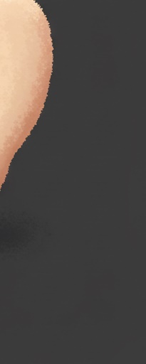 비수술 주걱턱 치아교정 이런 분들께 추천해요 관련 이미지 18