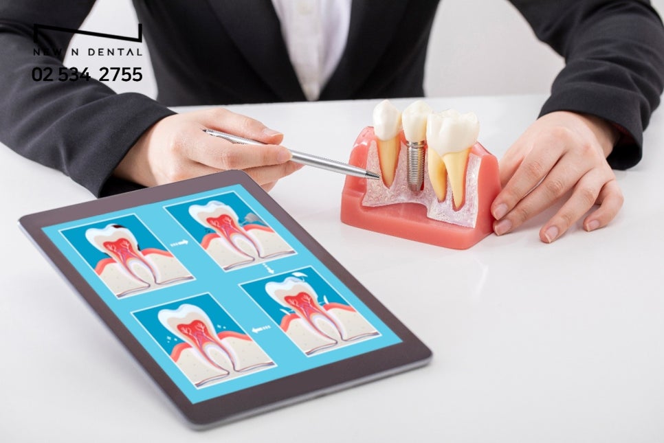 강남역임플란트수술 달라지는 일상의 즐거움 관련 이미지 6