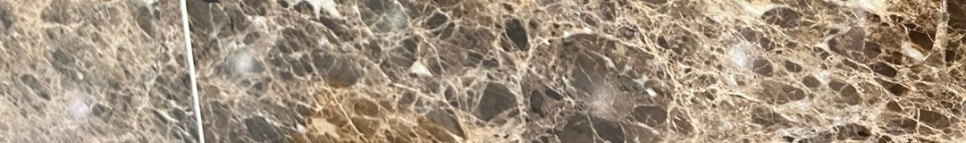 신논현역치아교정 당신의 라이프스타일에 맞는 선택 관련 이미지 29