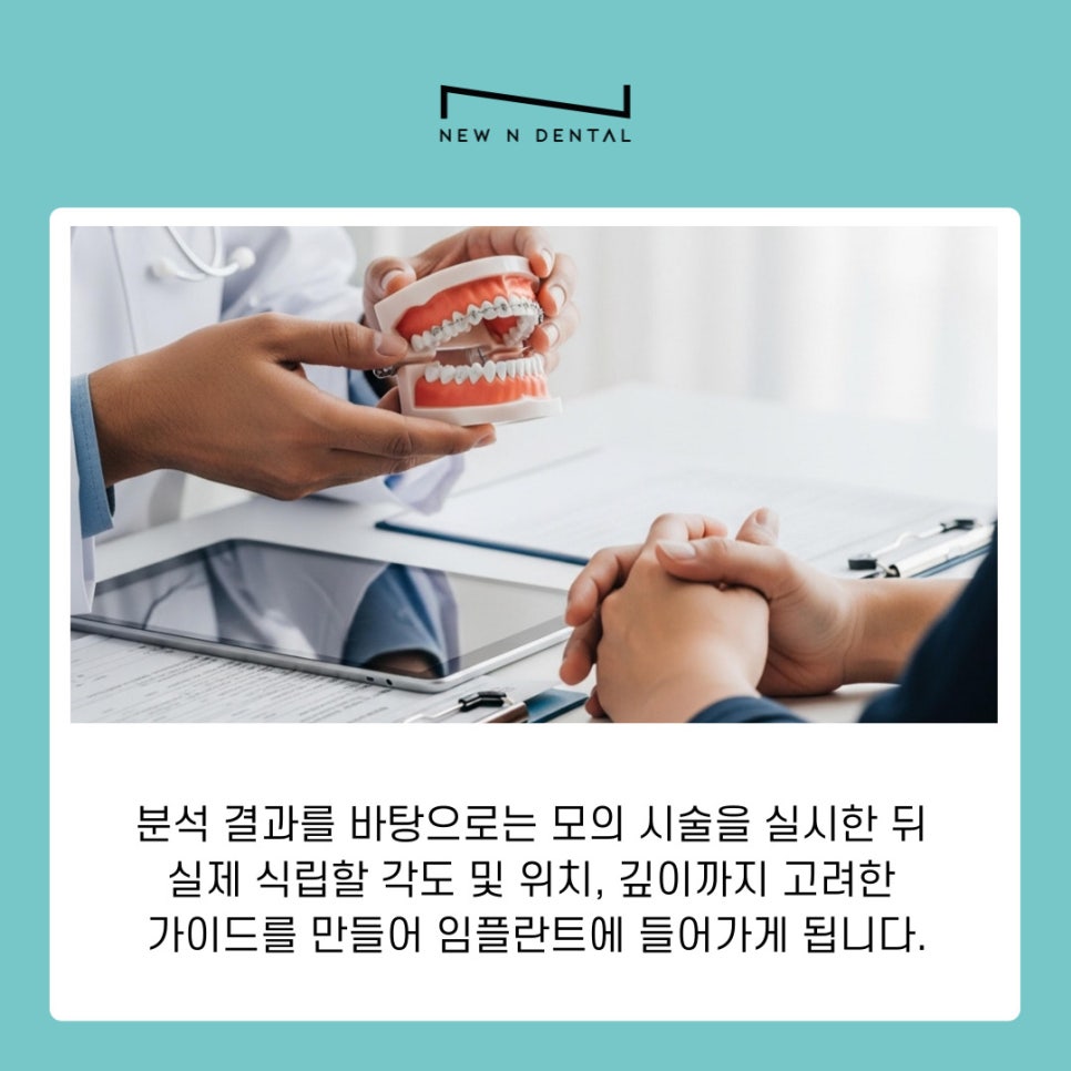 강남역치과 임플란트 시행하는 원인과 고려할 사항 관련 이미지 8