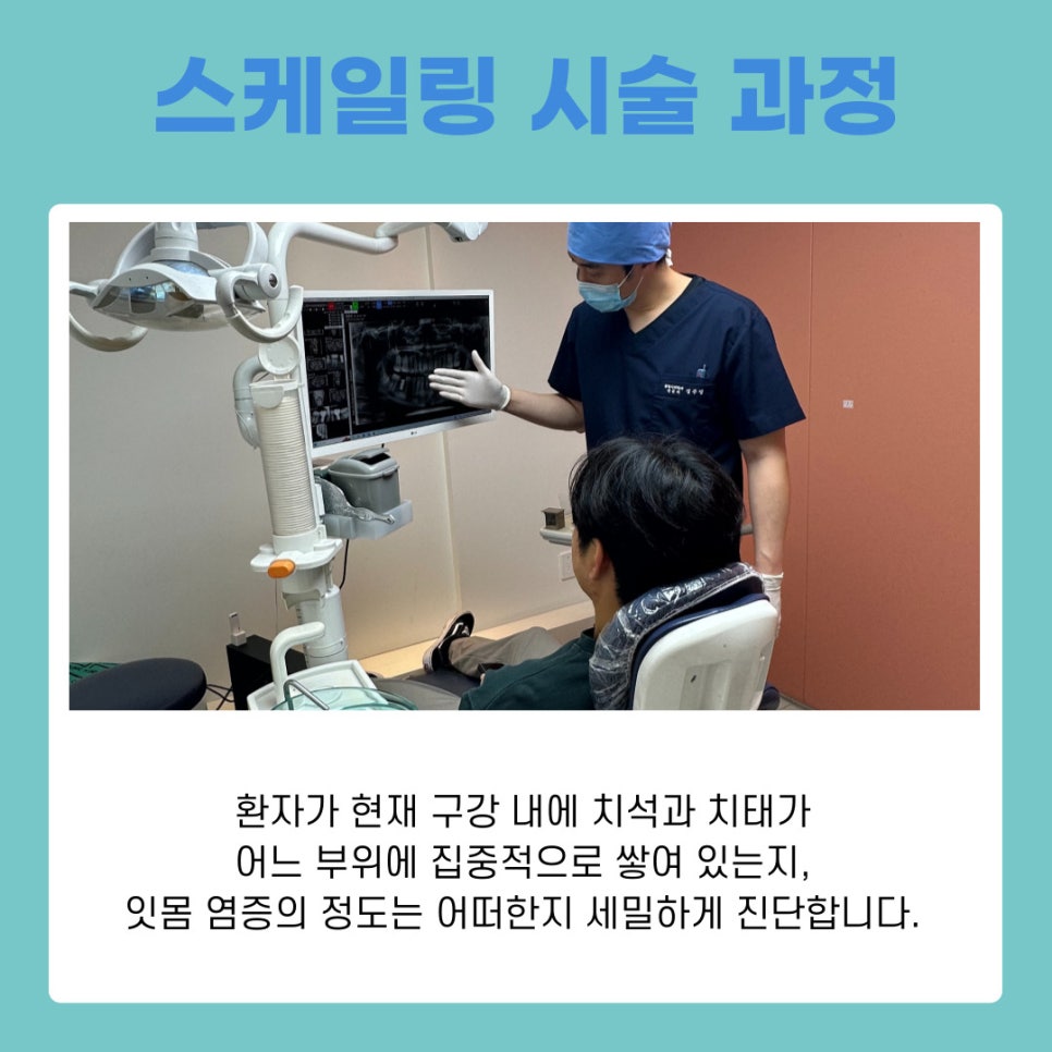 Gangnam Station Dental Clinic: Health Insurance Coverage Period and Benefits of Scaling image 7
