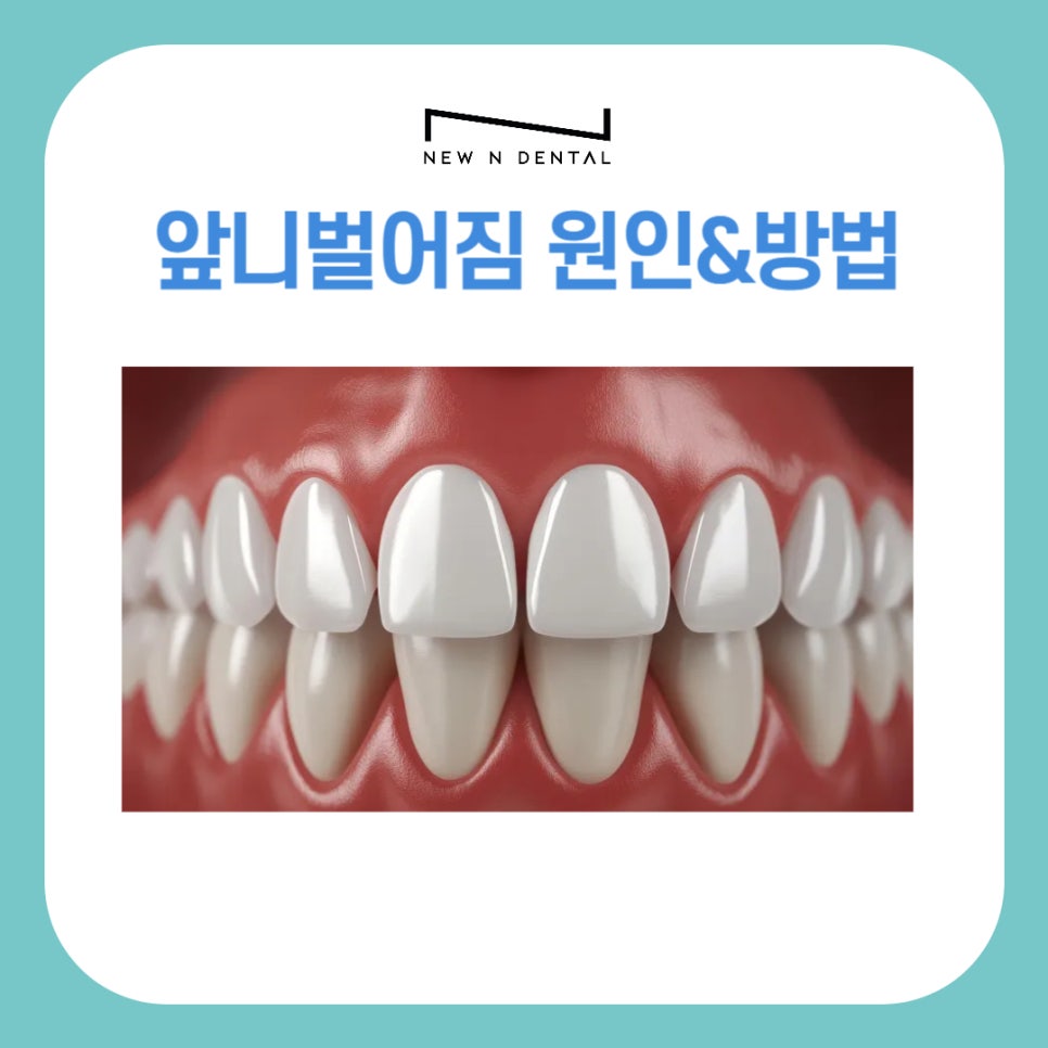 앞니 벌어짐 치료의 원인과 치료 방법 관련 이미지 1