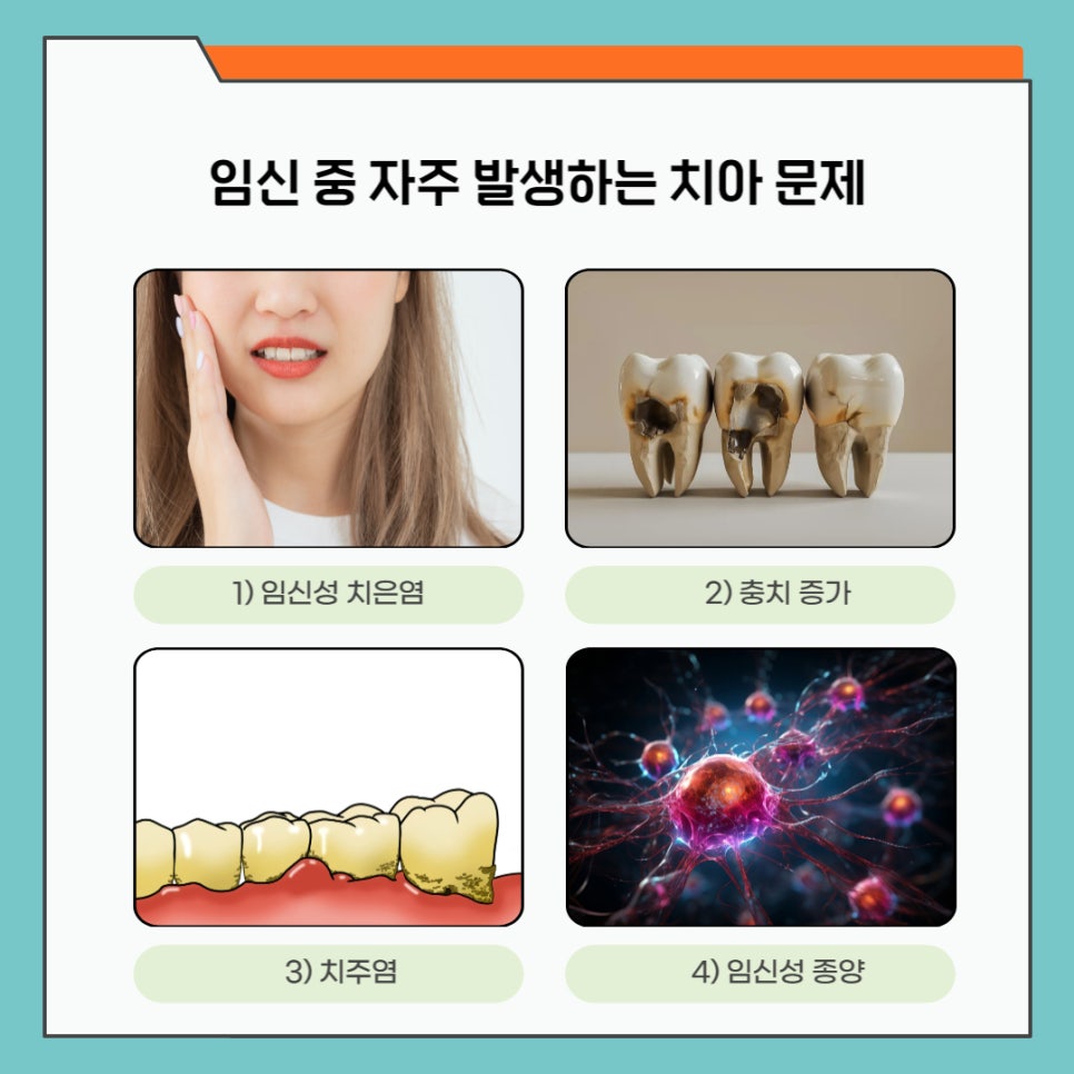 임산부 치아 건강 관리법 미리 알아두기 관련 이미지 3