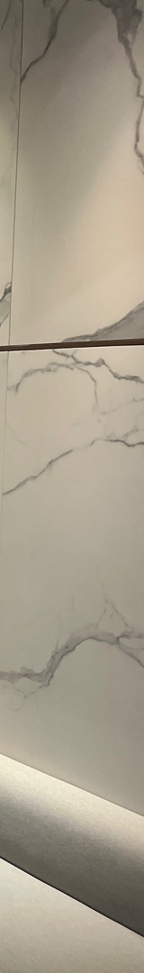 신논현치과 치아 삭제 없이 깔끔한 미소 관련 이미지 25