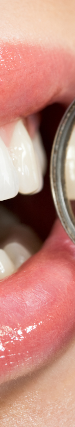 강남 무삭제라미네이트 치아깎지않는 개선방법 관련 이미지 14