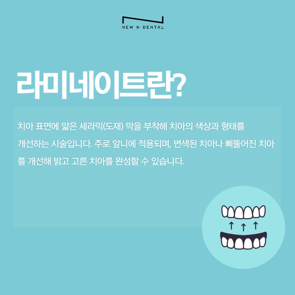 강남라미네이트 잘하는 곳 뉴엔치과 관련 이미지 3