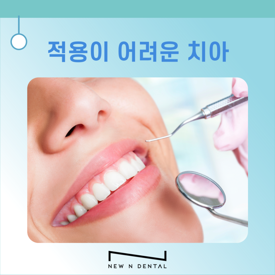 퍼스널라미 적용시키면 좋은 치아는? 관련 이미지 6