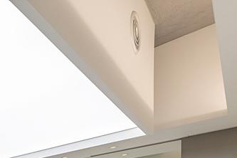 원데이 치아미백 변색의 원인과 후유증 없는 찐후기 관련 이미지 21