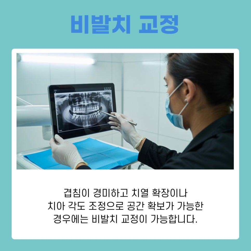 덧니 교정 발치 여부 어떻게 결정될까 관련 이미지 5
