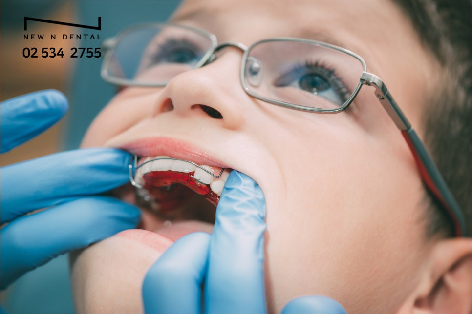 개방교합교정 생소하고 어렵다면 관련 이미지 6