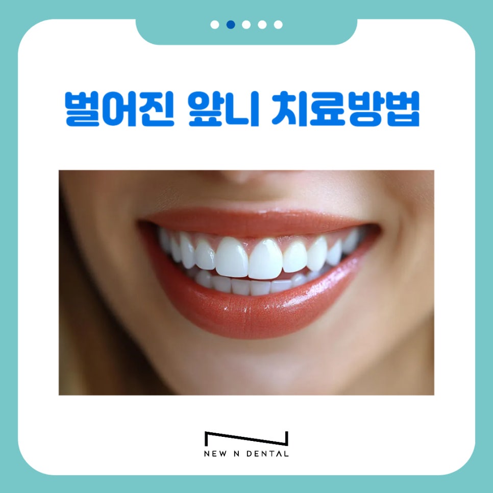 강남역치과 앞니 벌어짐 원인, 치료와 방법 관련 이미지 16