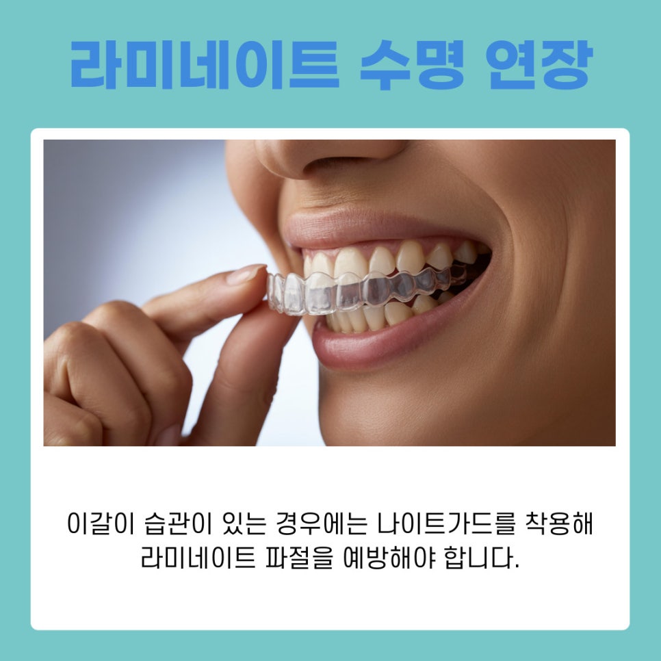 라미네이트 오래 유지하려면 알아야 할 점 관련 이미지 8