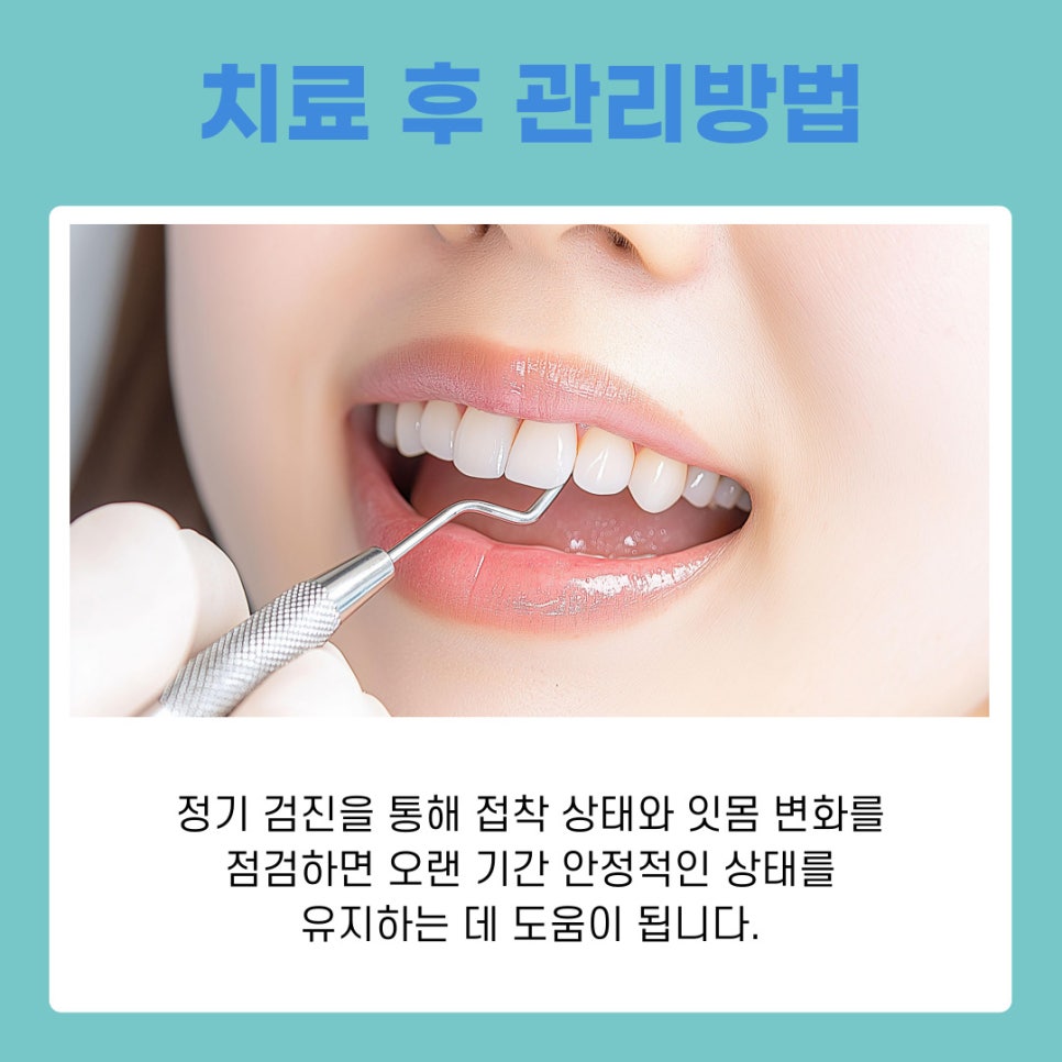 강남 논현동치과 치아미백 작용 원리와 유지 관리 방법 정리 관련 이미지 9