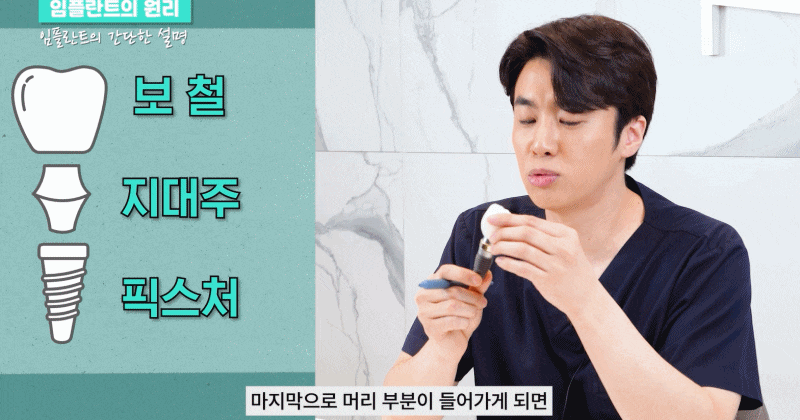 신논현역치과 임플란트 비용&middot;시술&middot;주의사항 총정리 관련 이미지 2