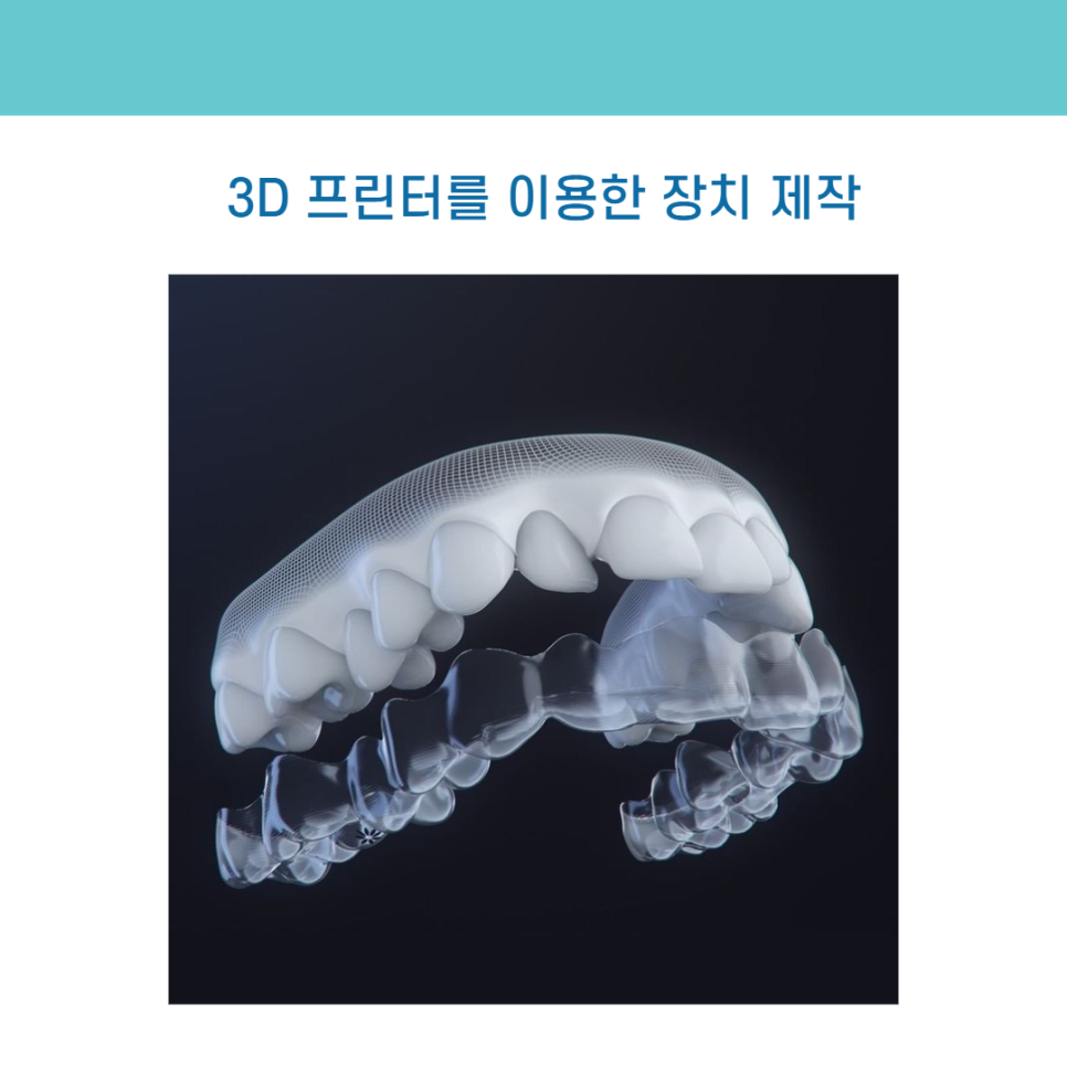 디지털 장비를 이용한 맞춤 치아 교정 관련 이미지 6