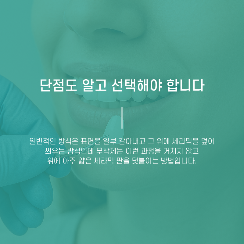 무삭제 라미네이트 저도 받을 수 있을까요? 관련 이미지 4