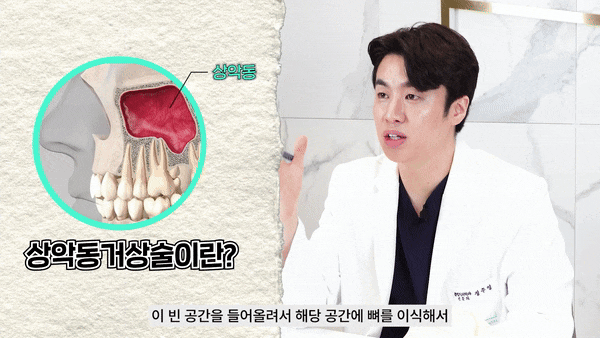 임플란트수술잘하는곳 세밀한 디지털 식립 관련 이미지 3