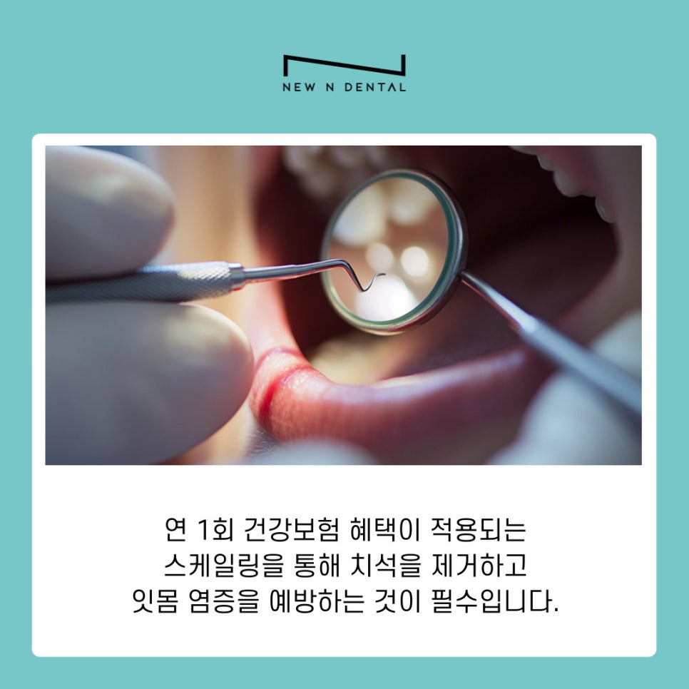 신사동 교정치과 투명교정 시작 전 꼭 알아야 할 체크리스트 관련 이미지 7