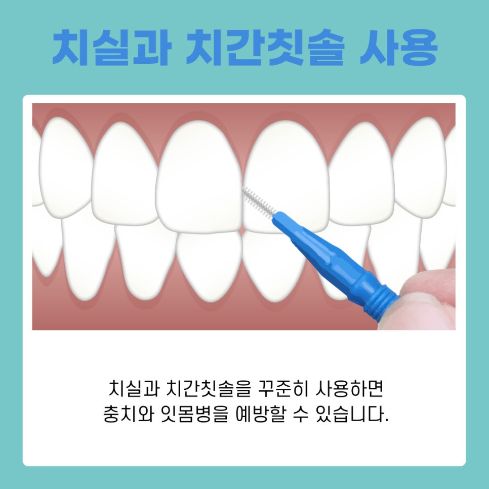 Seocho-dong Dental Clinic: Dental Regular Checkups and How to Prevent Cavities Properly image 7