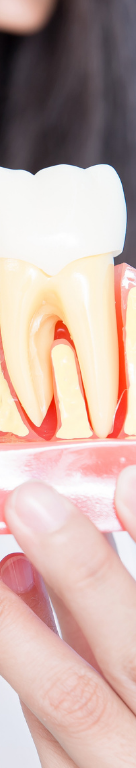 강남 임플란트 재수술, 어떤 경우에 필요할까 관련 이미지 14