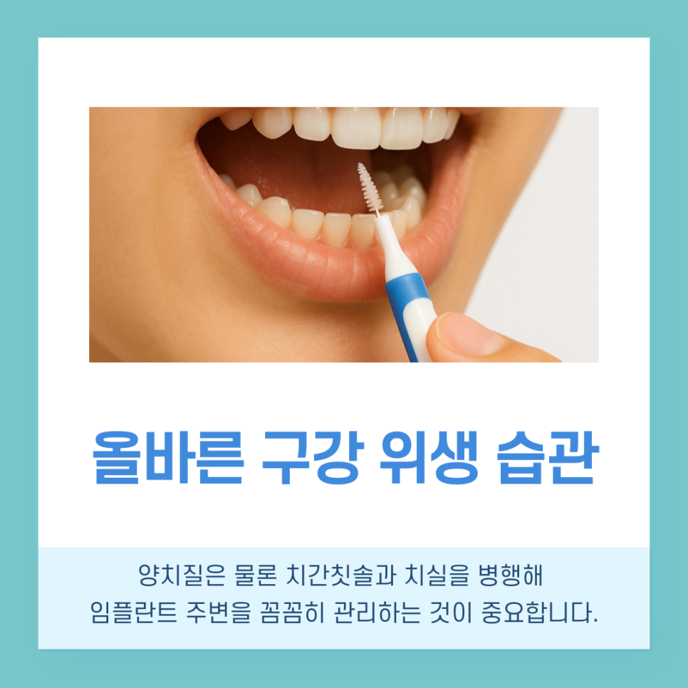 강남역치과 임플란트 수명 얼마나 사용할 수 있을까? 관련 이미지 6