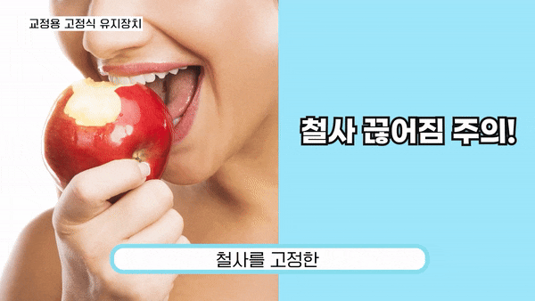 강남교정치과 단순한 미용을 넘어선 건강한 선택 관련 이미지 3