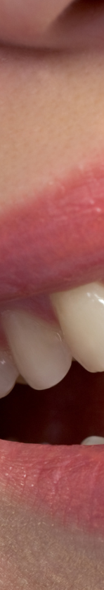 강남 무삭제라미네이트 치아깎지않는 개선방법 관련 이미지 10