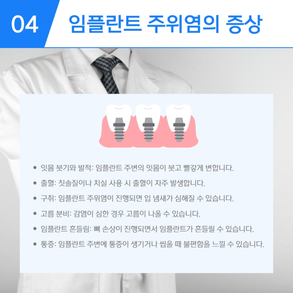 임플란트 주위염 원인과 예방방법 관련 이미지 5