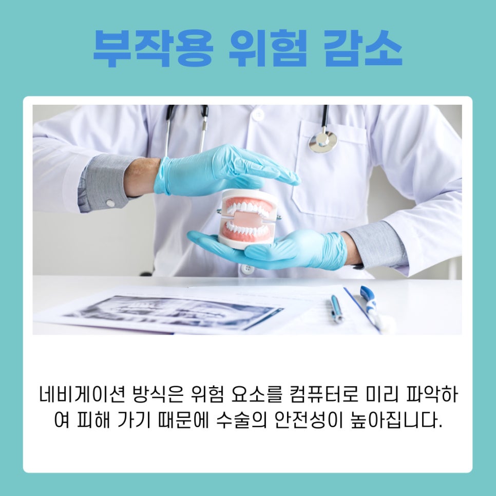 서초 임플란트치과 통증은 줄이고 정확도는 높이는 네비게이션 치료법 관련 이미지 9