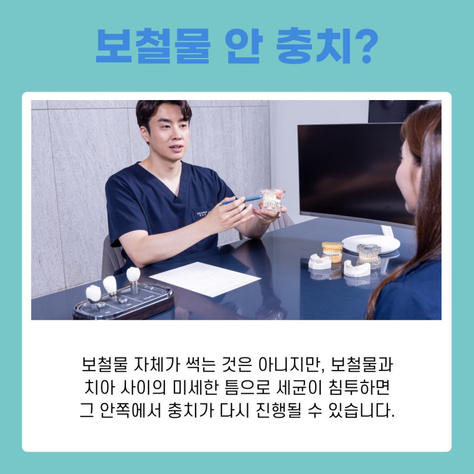 치과 가기 전 확인하세요 충치 단계별 치료 가이드 관련 이미지 10