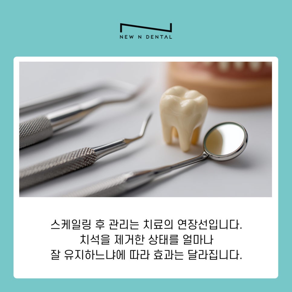 신사동 치과 스케일링후 관리 방법과 주의사항 관련 이미지 8