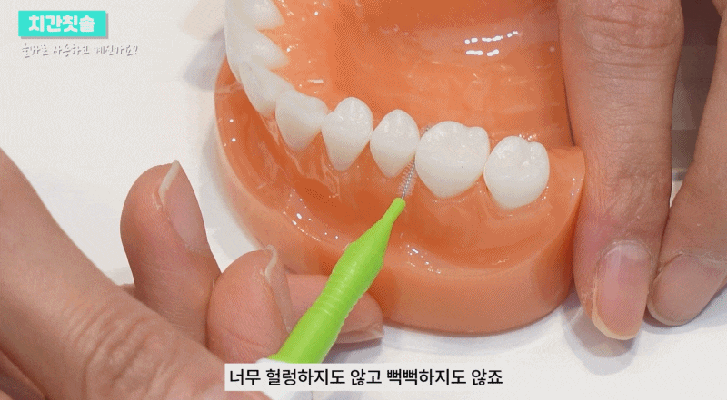 치간칫솔 치아관리 올바르게 사용하려면 관련 이미지 6