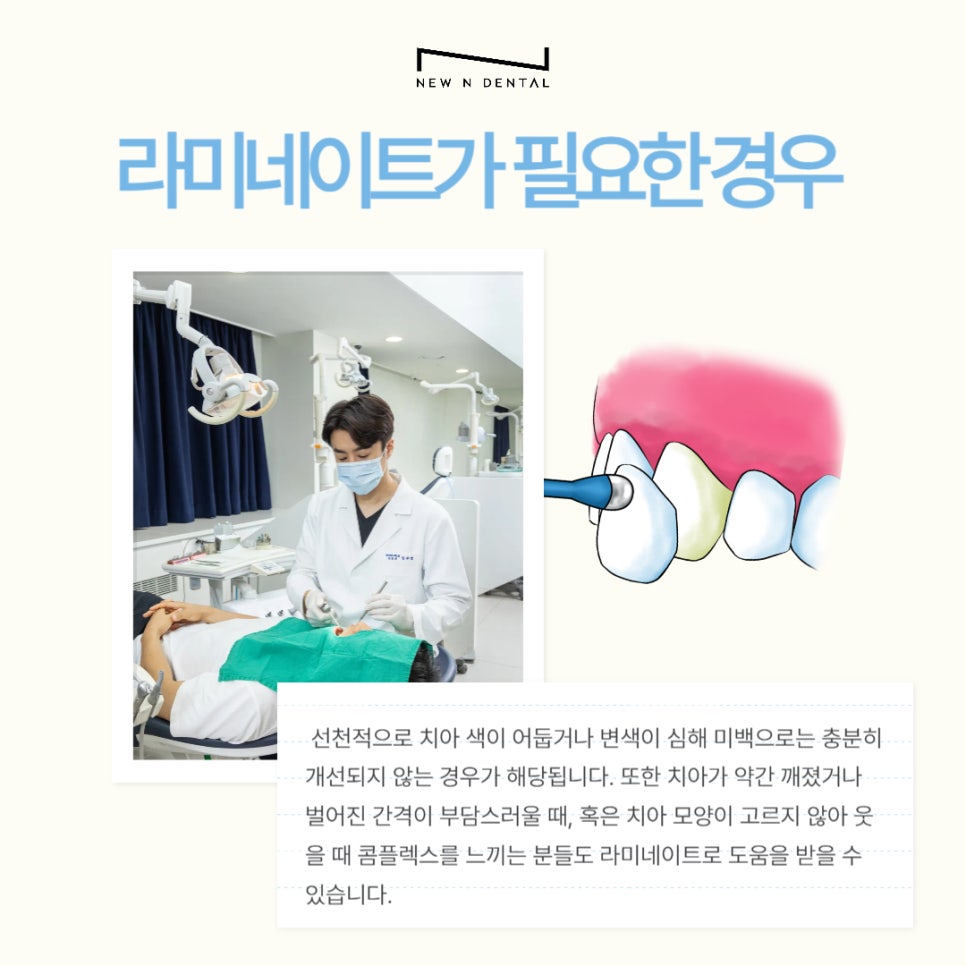 강남 무삭제라미네이트 잘하는 뉴엔치과 자연스러운 미소 관련 이미지 3