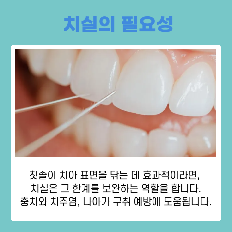 건강한 구강을 위한 치아관리방법, 치실사용순서 제대로 알기 관련 이미지 6