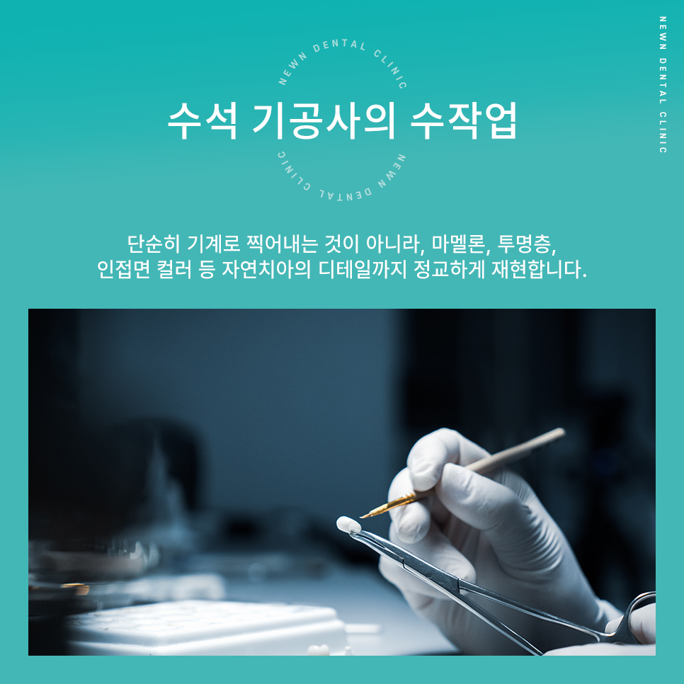 퍼스널라미 네츄럴ㅣ자연스러운 미소를 찾아주는 앞니성형, 무삭제 라미네이트 관련 이미지 10