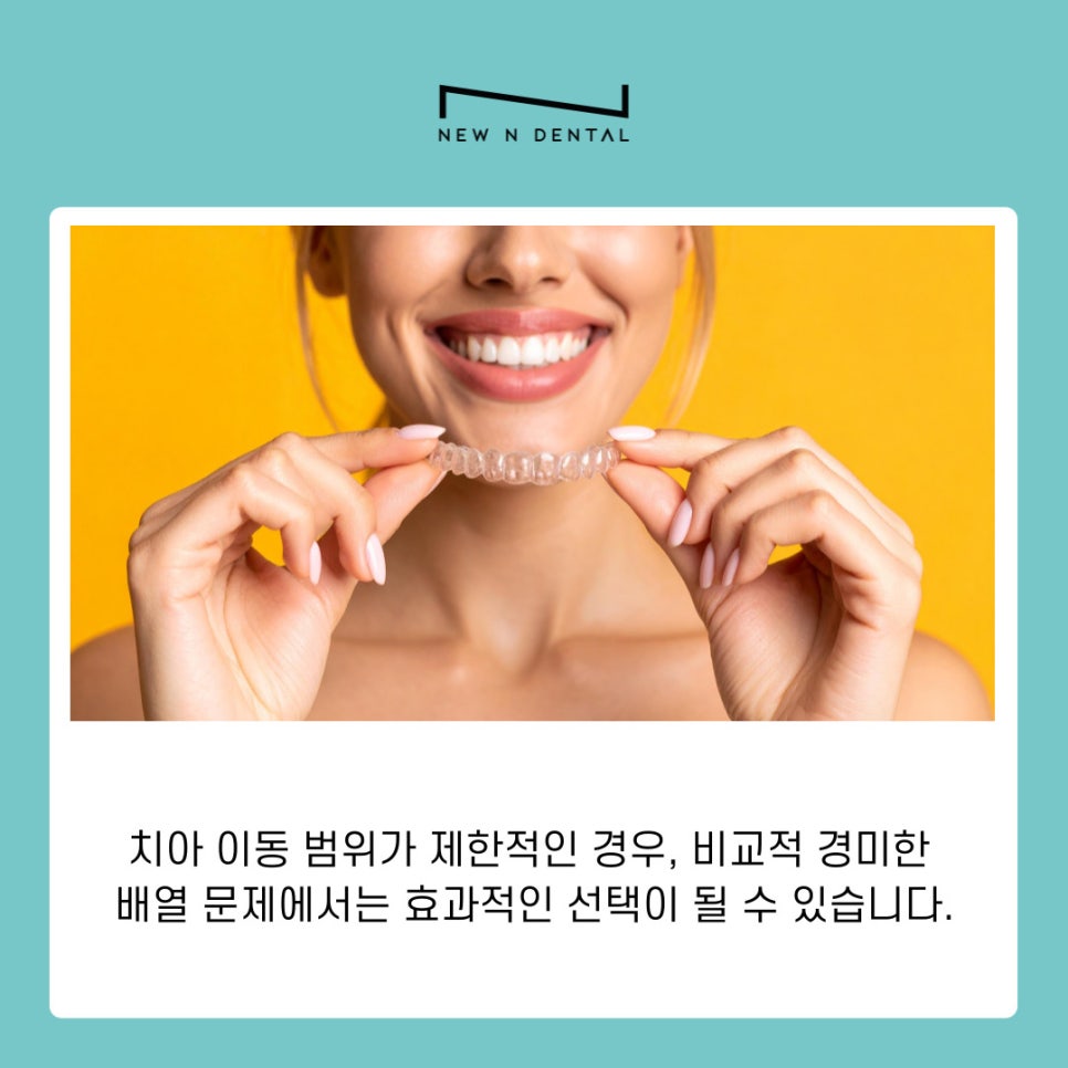 서초구교정치과 치료 전 반드시 알아야 할 기본 정보 정리 관련 이미지 5