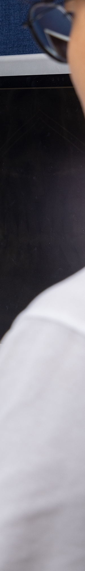 앞니 벌어짐 치료의 원인과 치료 방법 관련 이미지 24