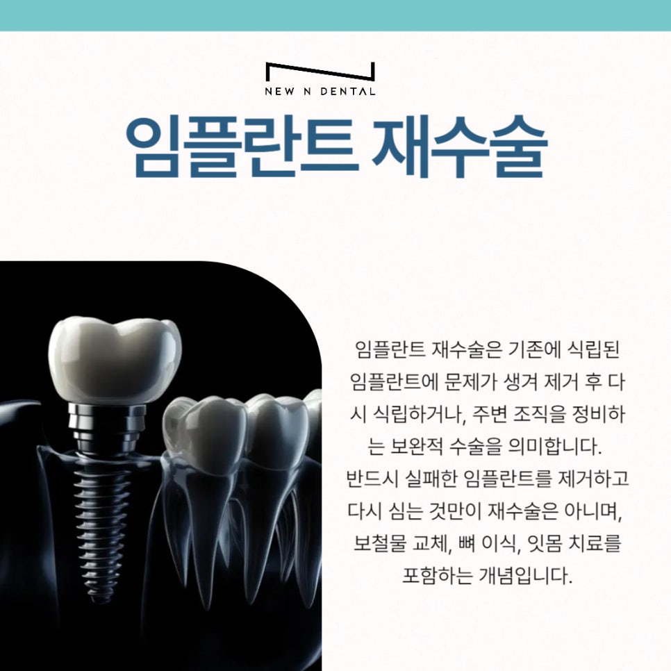 임플란트 재수술, 꼭 필요한 경우만 진행해야 합니다 관련 이미지 3